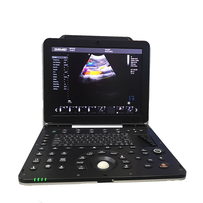 Factory selling Cheap Ultrasounds -
 DW-P5 – Dawei