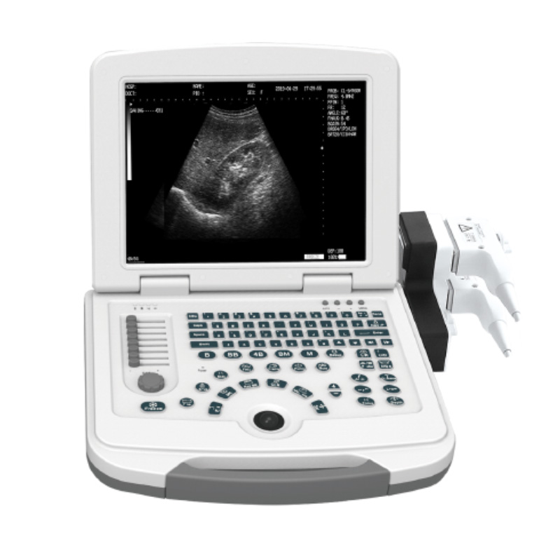 Factory supplied Mini Ultrasound Device -
 DW-500 black and white ultrasound imaging – Dawei