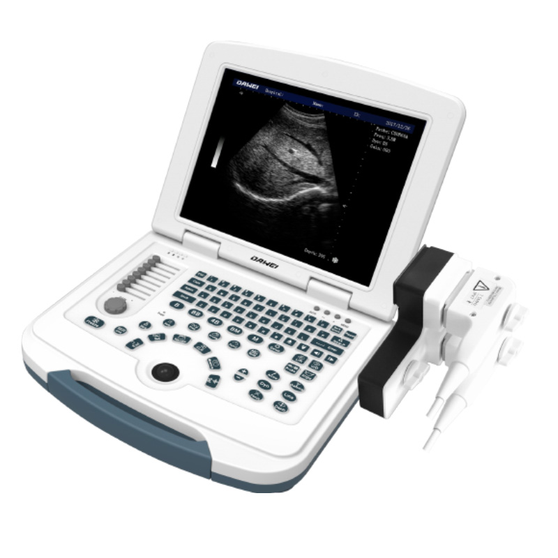 Competitive Price for Ultrasound Machine -
 DW-580 – Dawei