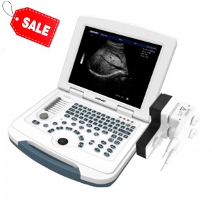 professional factory for Used Portable Ultrasound Machine -
 hot sell DW-580 black and white ultrasound machine price – Dawei
