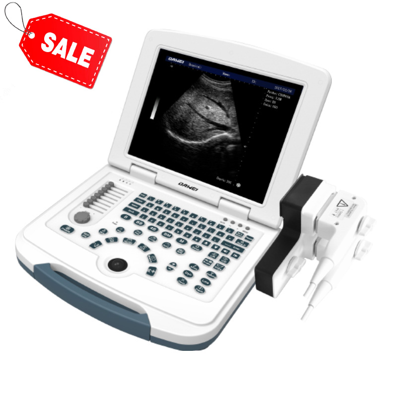 Reasonable price Portable Sonography Machine Price -
 hot sell DW-580 black and white ultrasound machine price – Dawei