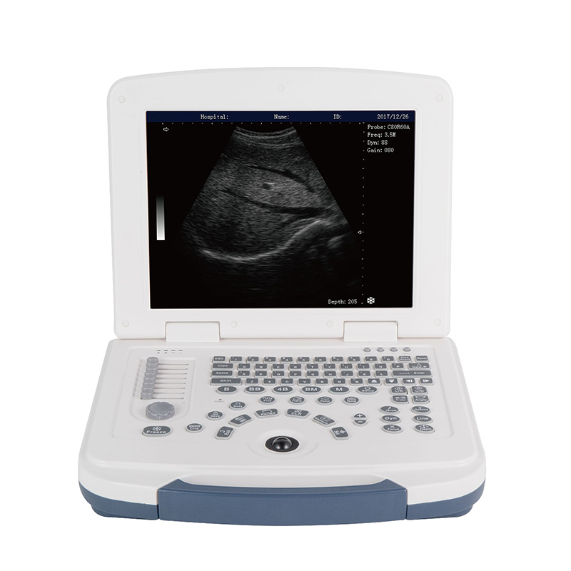 Hot sale 3d Ultrasound Machine Price -
 DW-580 – Dawei