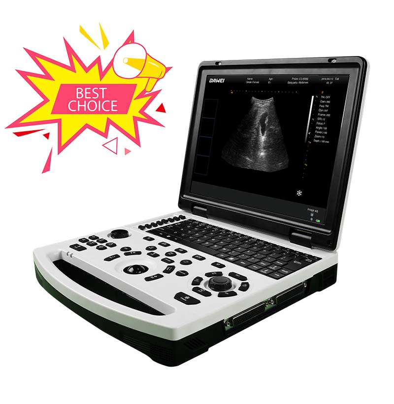 New Fashion Design for Cheap Portable Ultrasound -
 DW-690 cheap laptop black and white ultrasound system – Dawei