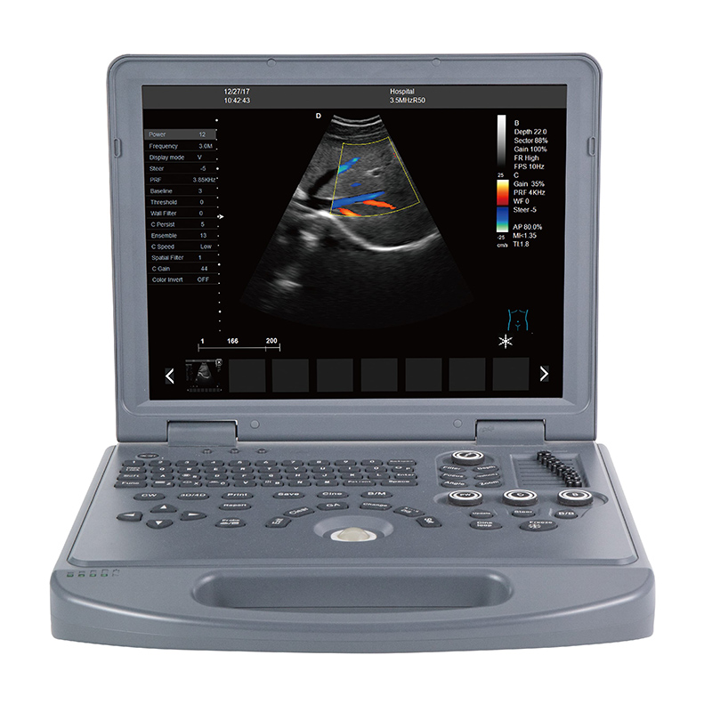 Well-designed Portable Echocardiography Machine -
 DW-L3  – Dawei
