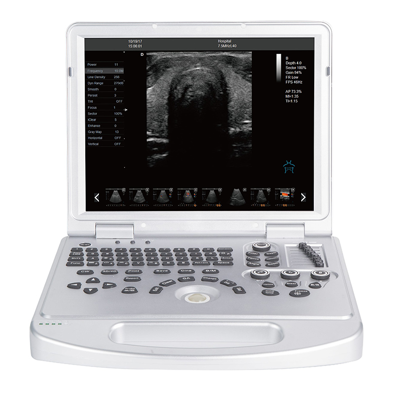 Factory making Diagnostic Ultrasound -
 DW-L5 – Dawei