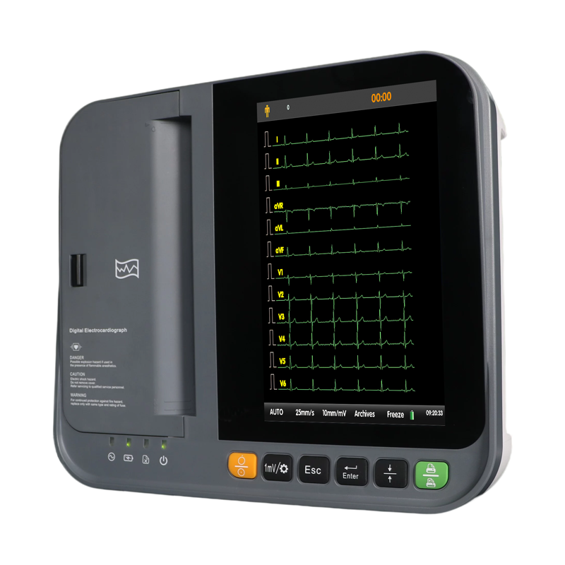 Good Quality Best Veterinary Ultrasound Machine -
 DE-12Channel ECG Machine – Dawei Featured Image