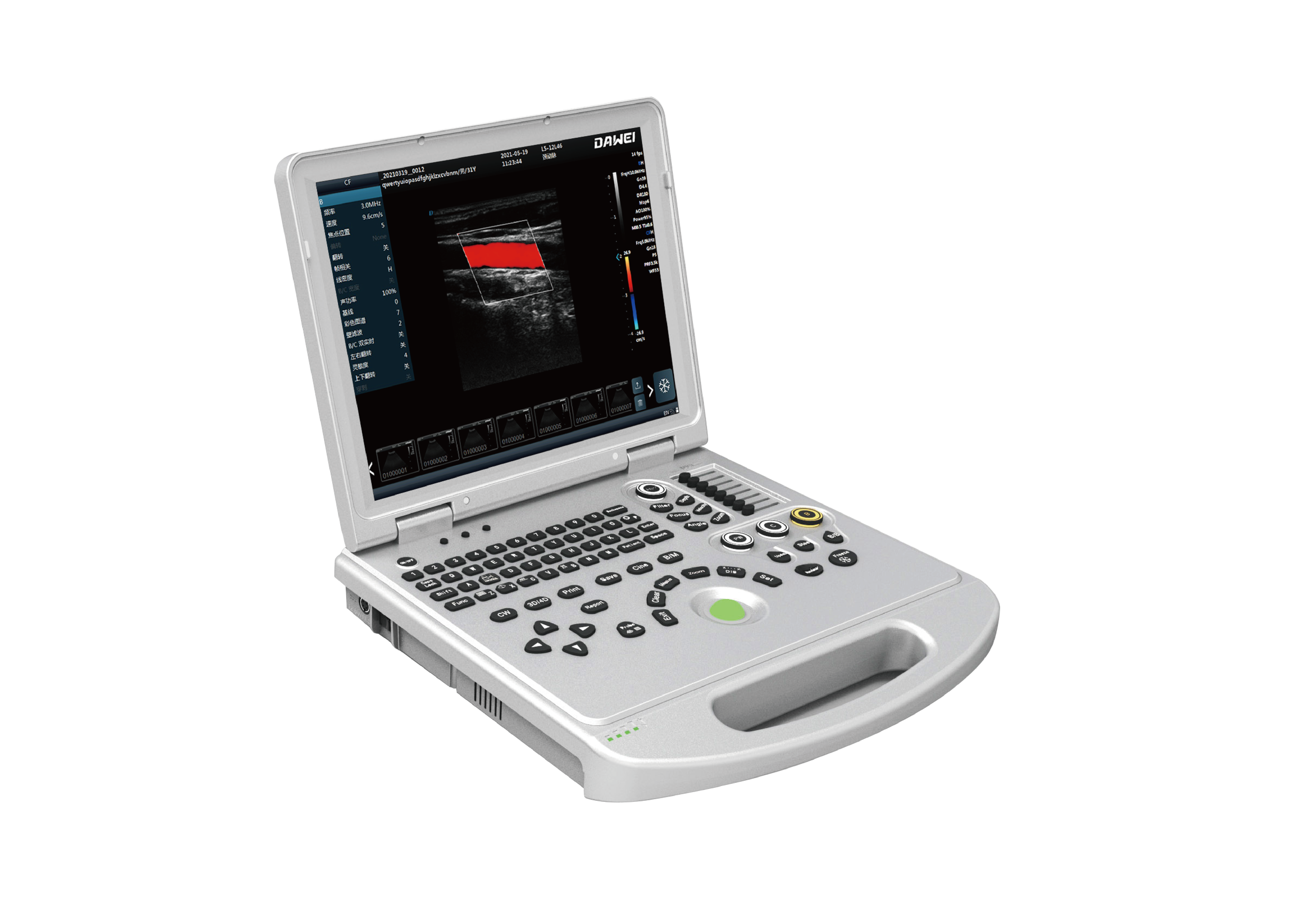 OEM/ODM Manufacturer Mobile Ultrasound Machine -
 DW-L5(DW-PF522) color doppler ultrasound machine – Dawei