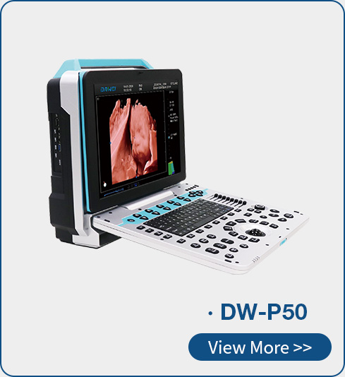 https://www.ultrasounddawei.com/4d5d-medical-echo-portable-ultrasound-scan-machine-product/