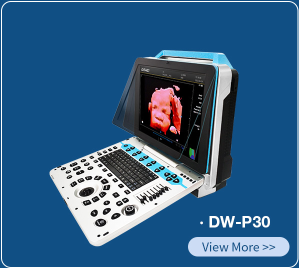 https://www.ultrasounddawei.com/best-4d5d-color-doppler-portable-ultrasound-diagnosis-system-product/