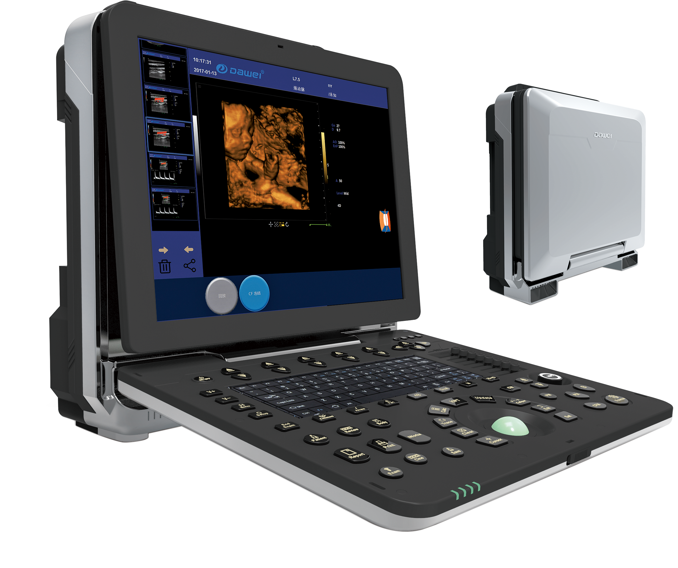 DW-P8—Portable Ultrasound dedicated to Women´s Health
