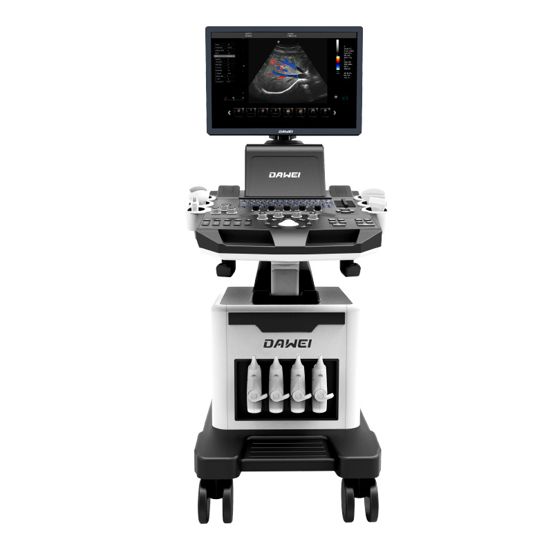 OEM/ODM China Colour Doppler Ultrasound Price -
 DW-F5 economical type 3d4d doppler ultrasound baby scanner imaging – Dawei