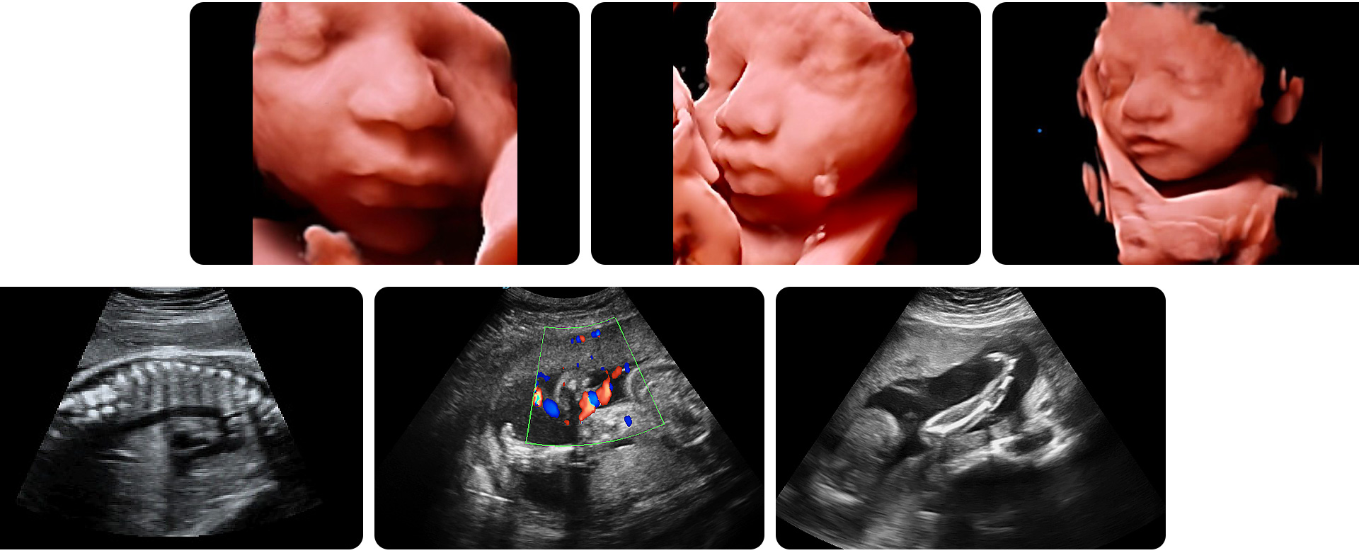 https://www.ultrasounddawei.com/full-digital-ultrasound-machine-for-pregnancy-product/
