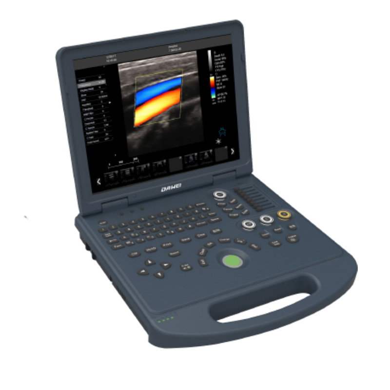 100% Original In Home Ultrasound Machine -
 DW-L3 laptop color doppler ultrasound scan system – Dawei