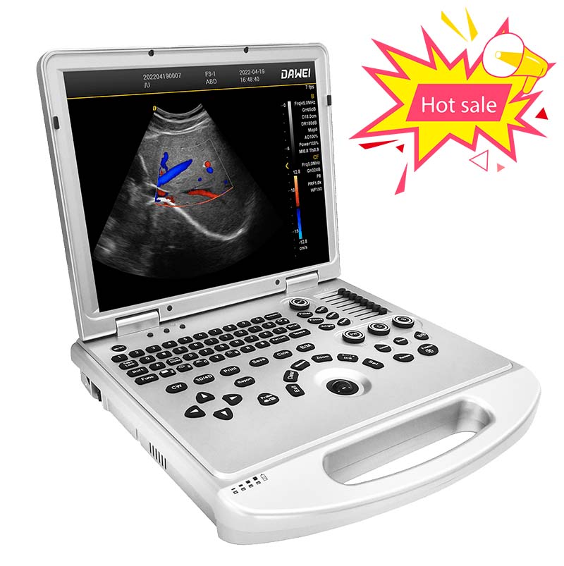 Europe style for Portable Ultrasonography Machine -
 DW-L3 portable medical color Doppler ultrasound echo machine – Dawei