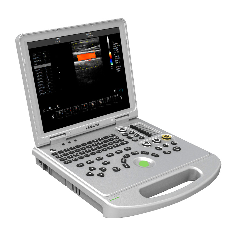 Professional China Ultrasound Imaging -
 DW-L5（PF522） economical type laptop color doppler ultrasound baby scan – Dawei
