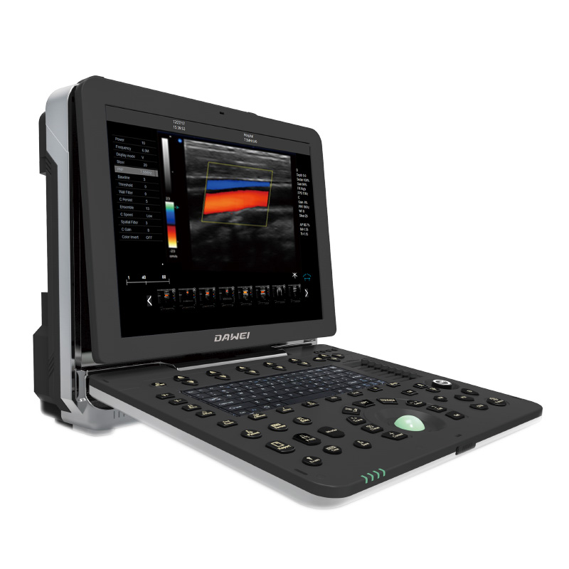 Manufacturer for Color Doppler Ultrasound Cost -
 DW-P5 3d 4d color doppler ultrasound machine – Dawei