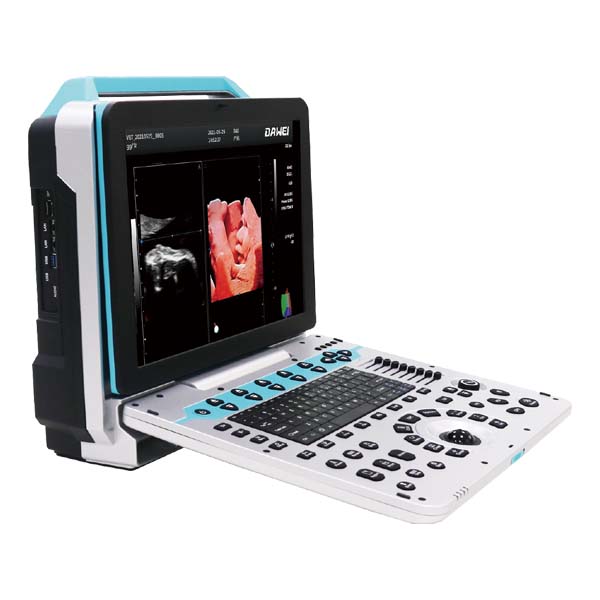 Manufacturer for Ultrasound Machine Cost -
 DW-P50(P5PRO) 4d/5d medical echo portable ultrasound scan machine  – Dawei