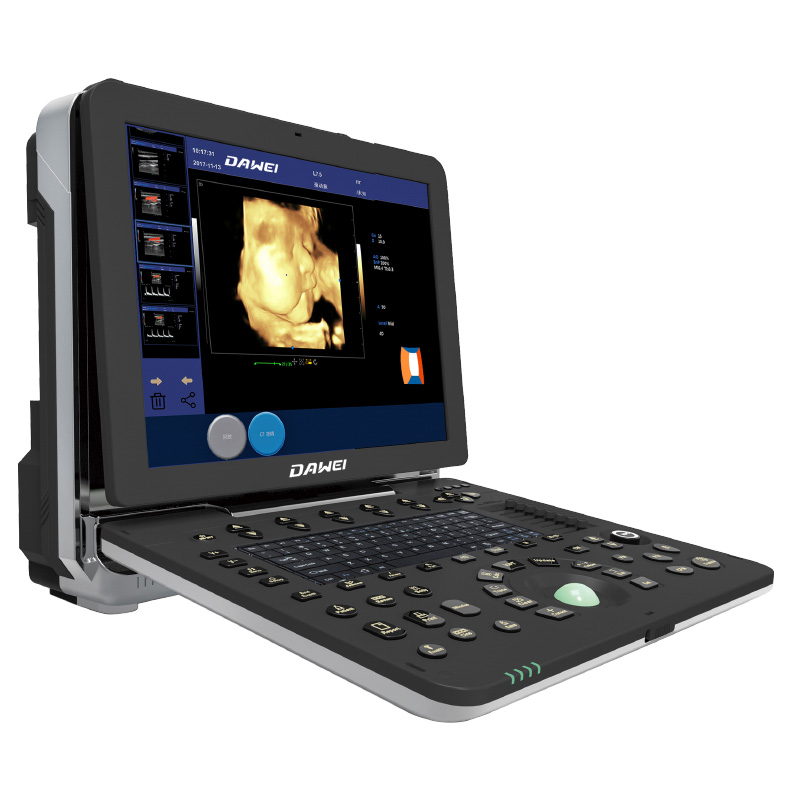 Excellent quality Doppler Test For Heart -
 DW-P6(PF580) color doppler baby 4d ultrasound scan machine – Dawei