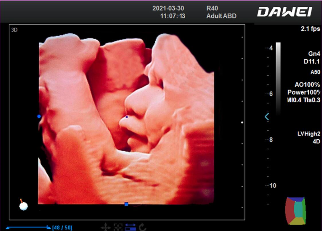 5D LIVE REAL-SKIN IMAGE ,  BRINGS A NEW VISUAL EXPERIENCE