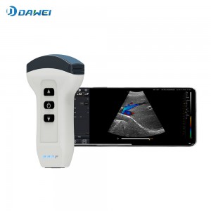 Professional China Echocardiogram Machine For Sale -
 Wireless Handheld Ultrasound Scanner – Dawei