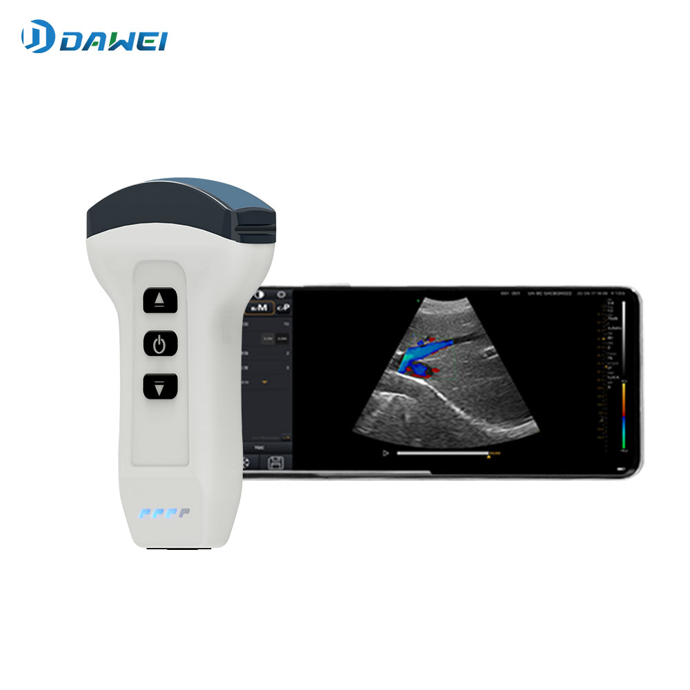 Factory Promotional Diagnostic Ultrasound Machine -
 Wireless Handheld Ultrasound Scanner – Dawei Featured Image