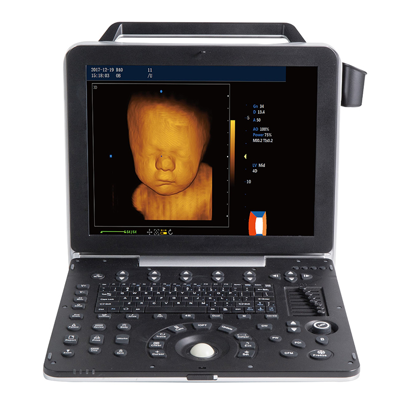 Free sample for Portable Ultrasound Machine For Sale -
 DW-P6 – Dawei