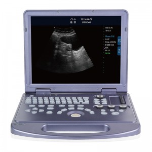 DW-360 laptop black and white ultrasound machine price