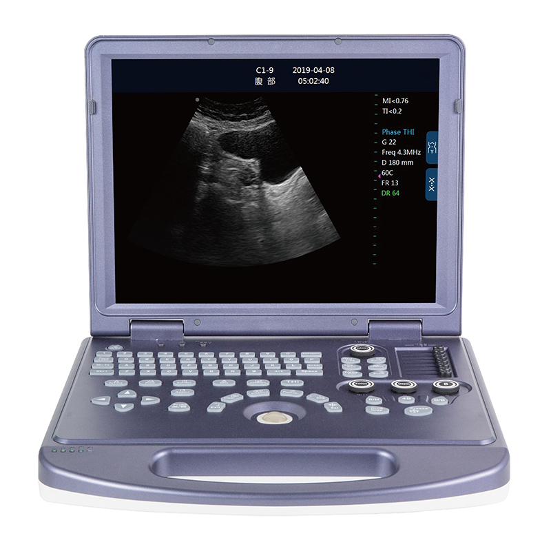 Competitive Price for Ultrasound Machine -
 DW-360 laptop black and white ultrasound machine price – Dawei