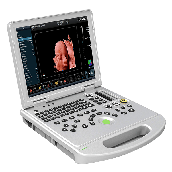 Wholesale Price Handheld Sonogram -
 DW-L50(L5PRO) 3D/4D/5D Portable medical echo ultrasound scan machine – Dawei