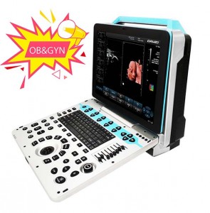 Professional China Ultrasound Imaging -
 DW-P30 best 4D/5D color doppler portable ultrasound diagnosis system – Dawei
