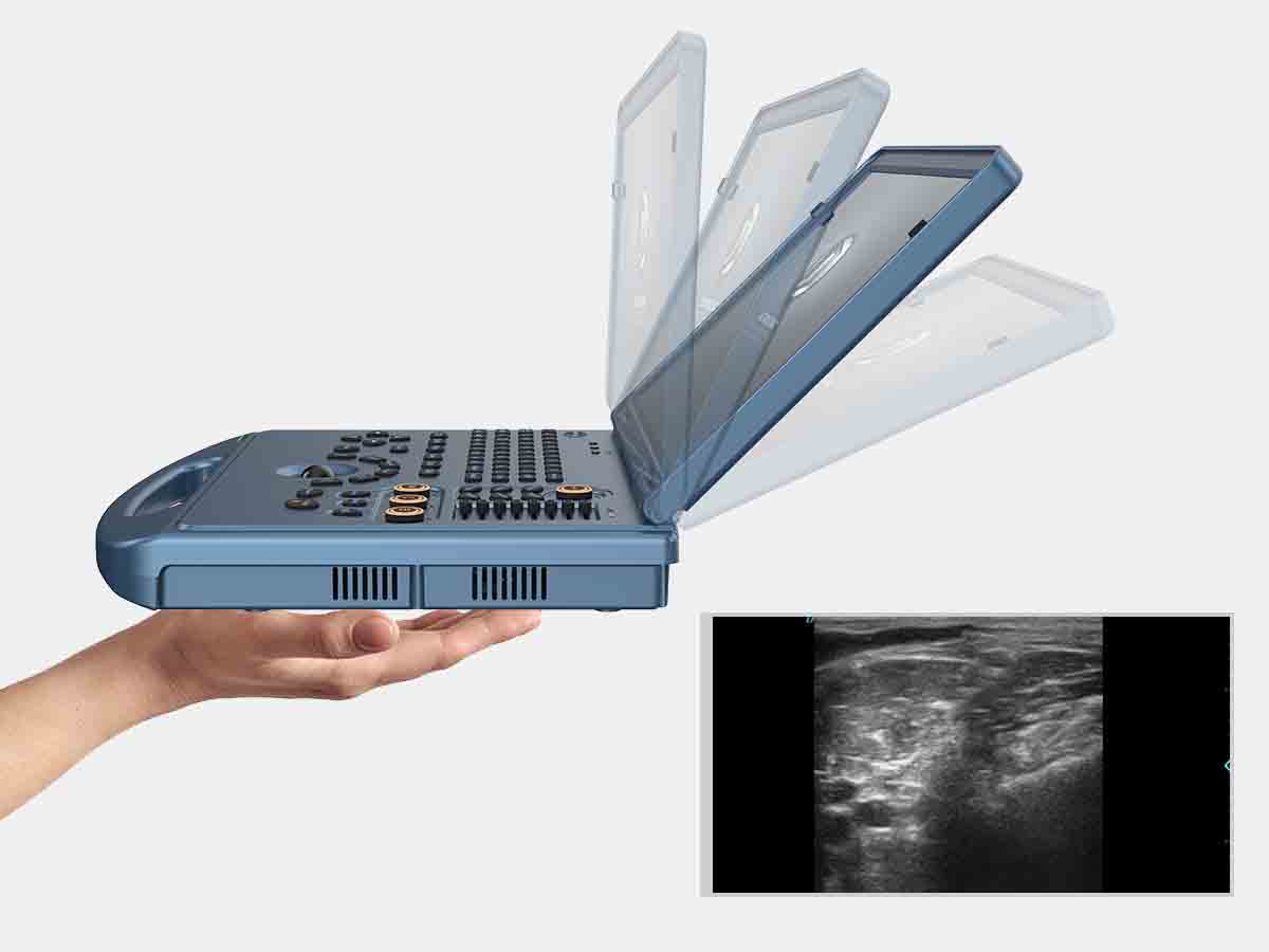 L5 MSK ultrasound machine (2)