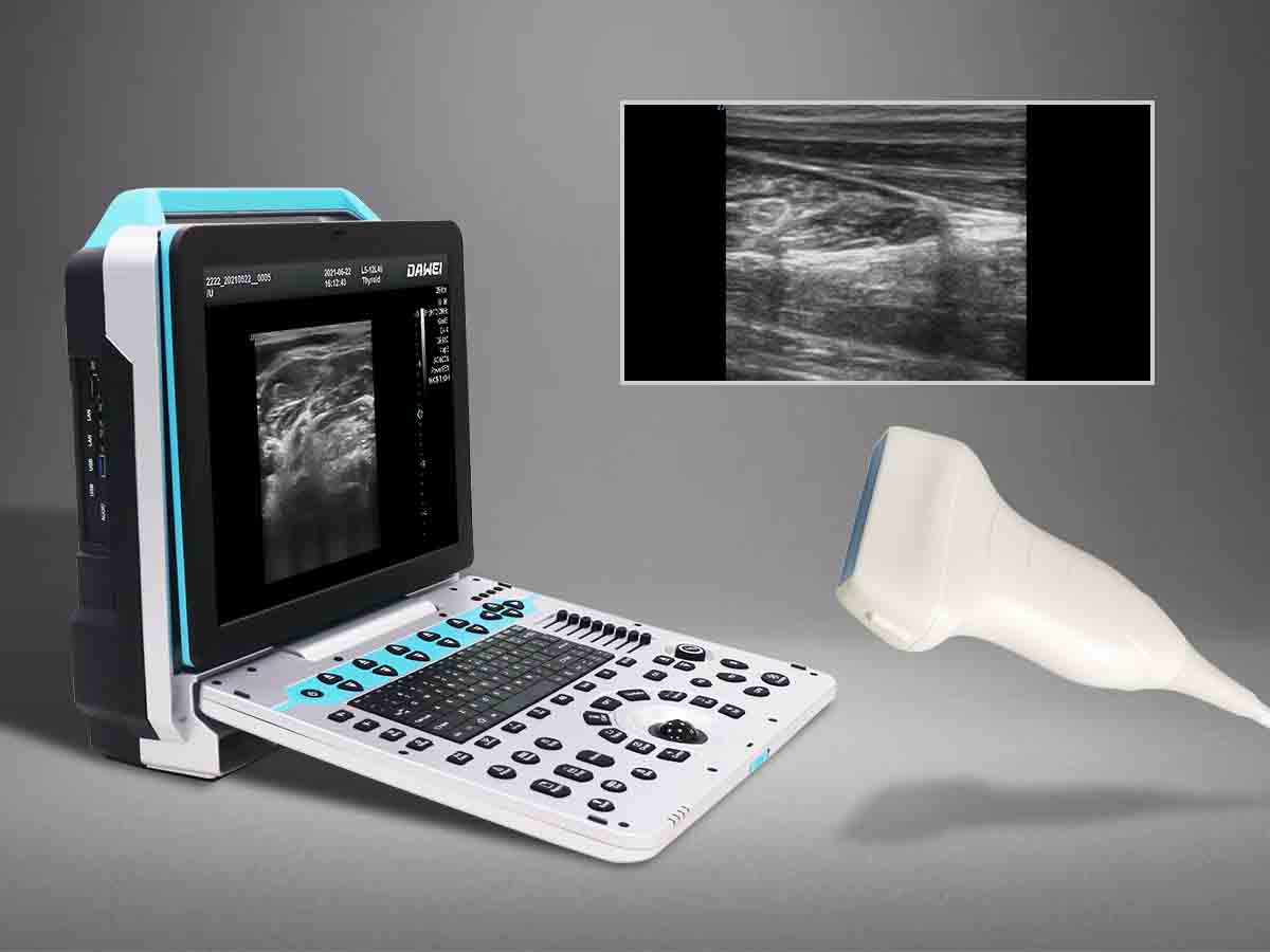 P5 MSK ultrasound machine