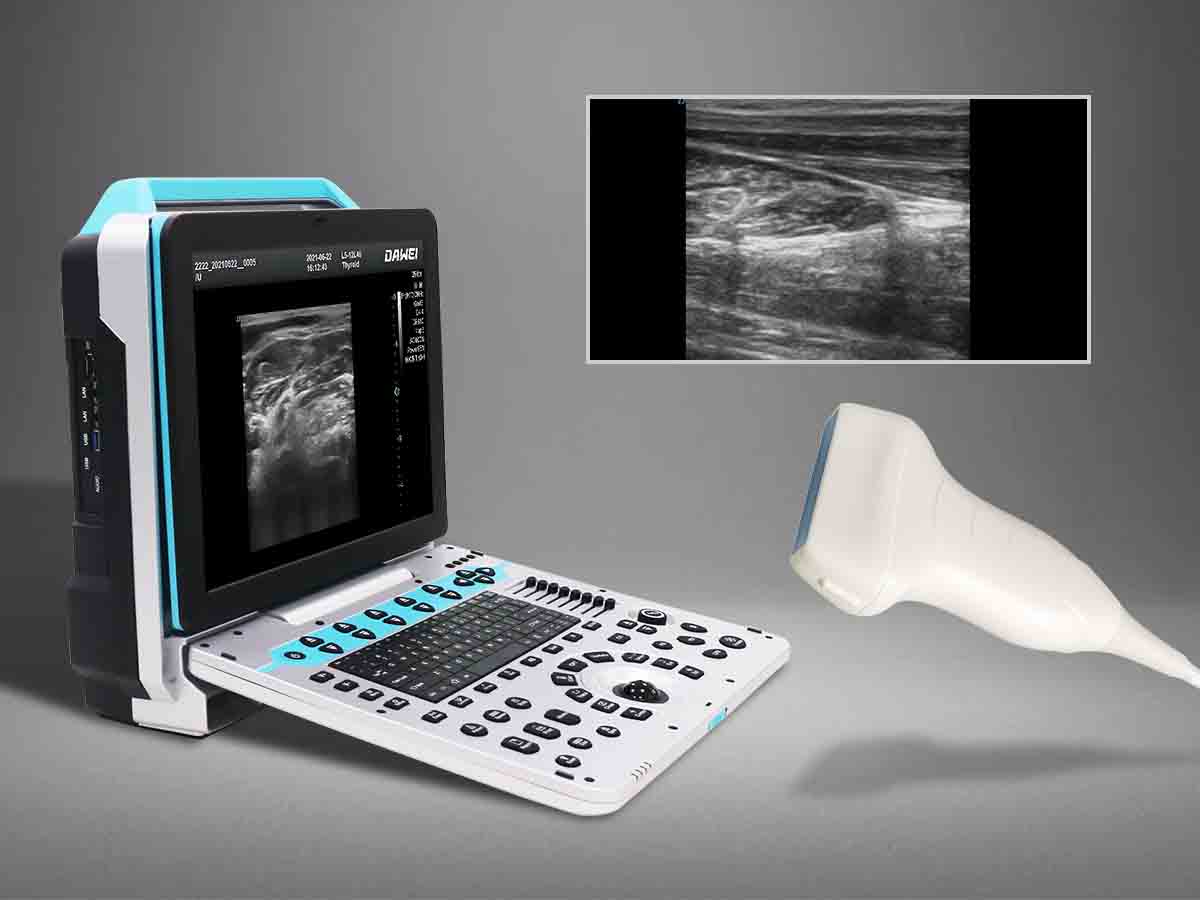 P5 MSK makîneya ultrasound