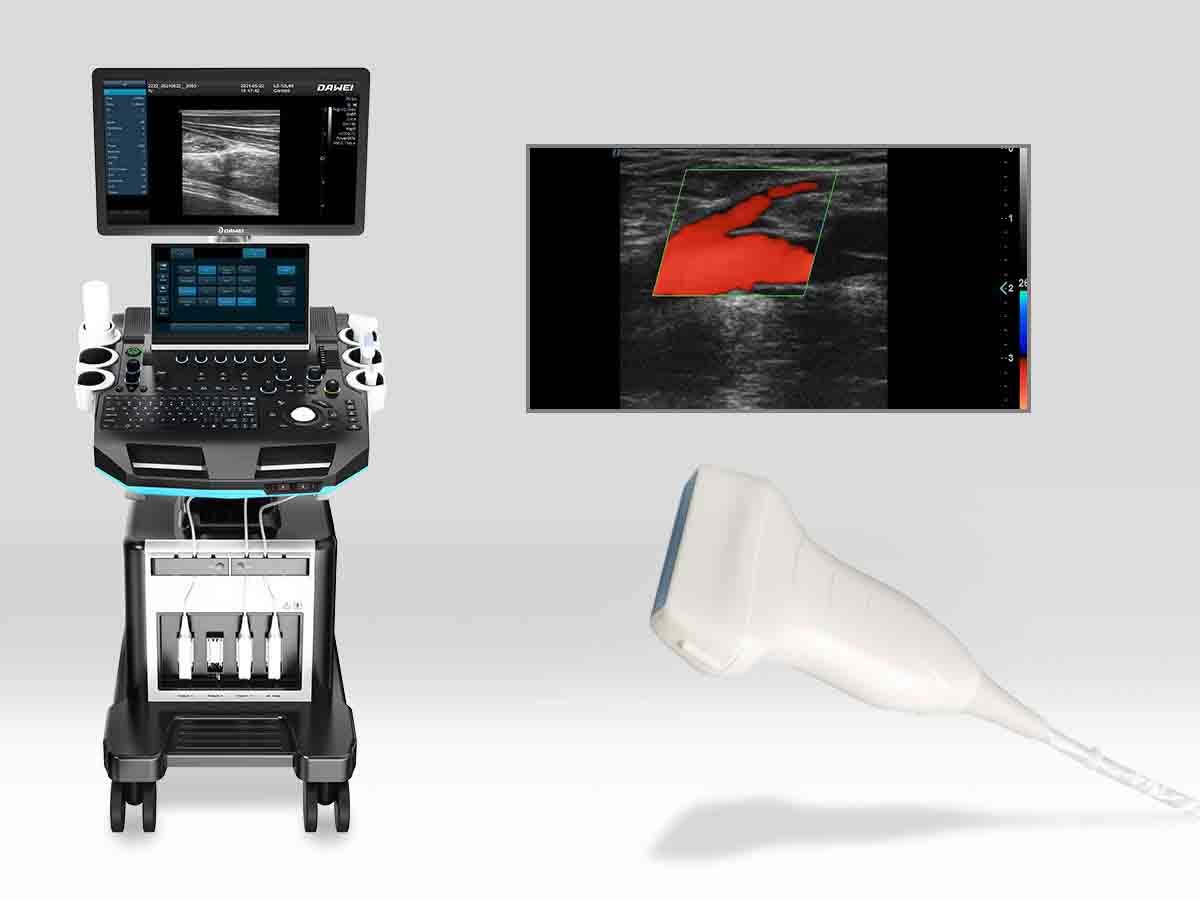 https://www.ultrasounddawei.com/news/msk-ultrasound-machine-for-sale/