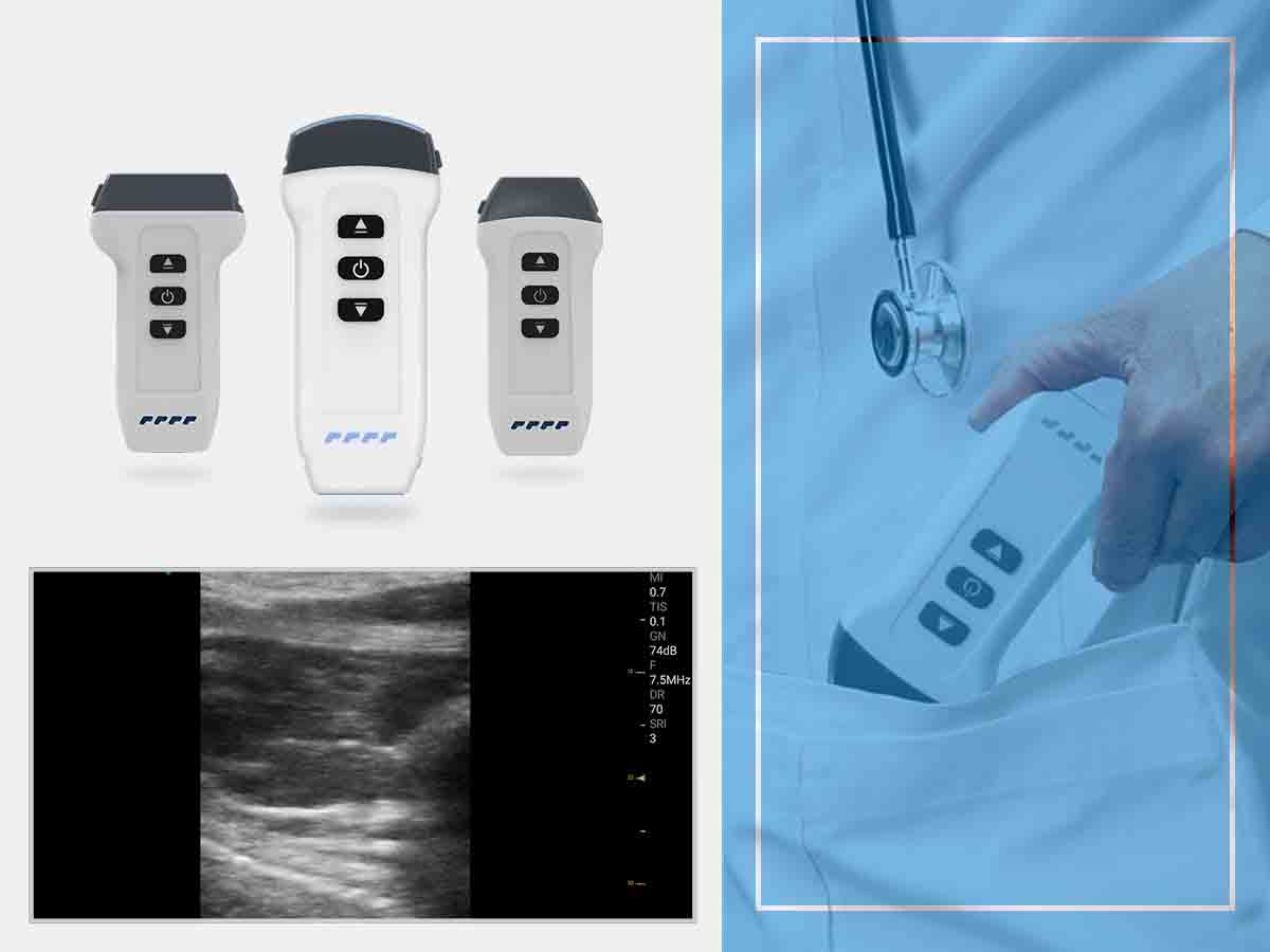 12.18-wireless ultrasound MSK ultrasound machine