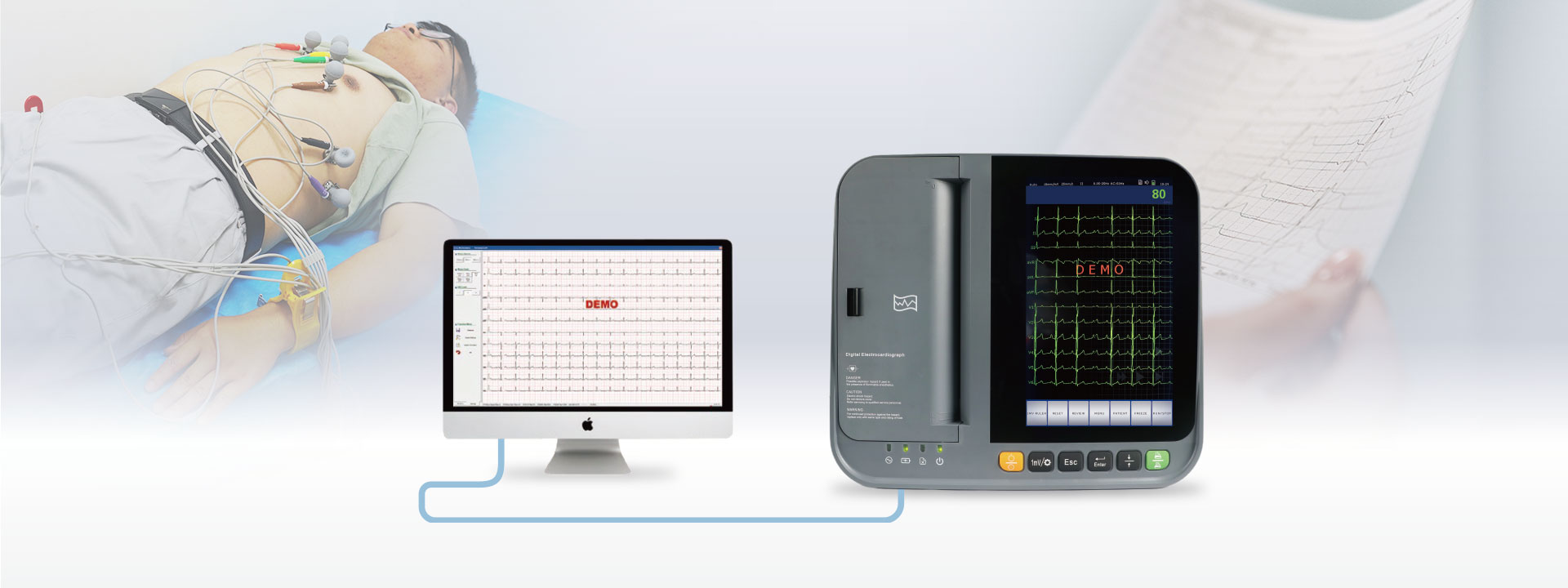 https://www.ultrasounddawei.com/news/exploring-the-benefits-of-12-lead-ecg-machines/