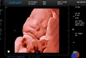 Esta es la imagen clínica 5D de dawei medical