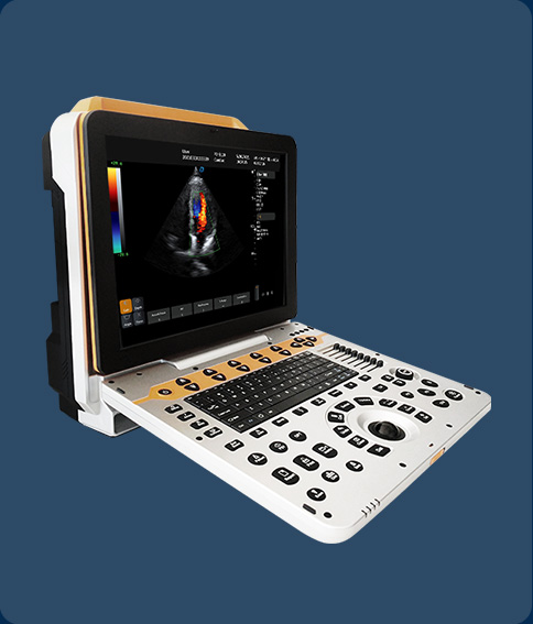 https://www.ultrasounddawei.com/dw-p60-portable-4d-cardiovascular-ultrasound-scanner-machine-product/