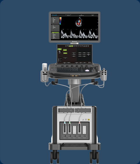 https://www.ultrasounddawei.com/doppler-ultrasound/