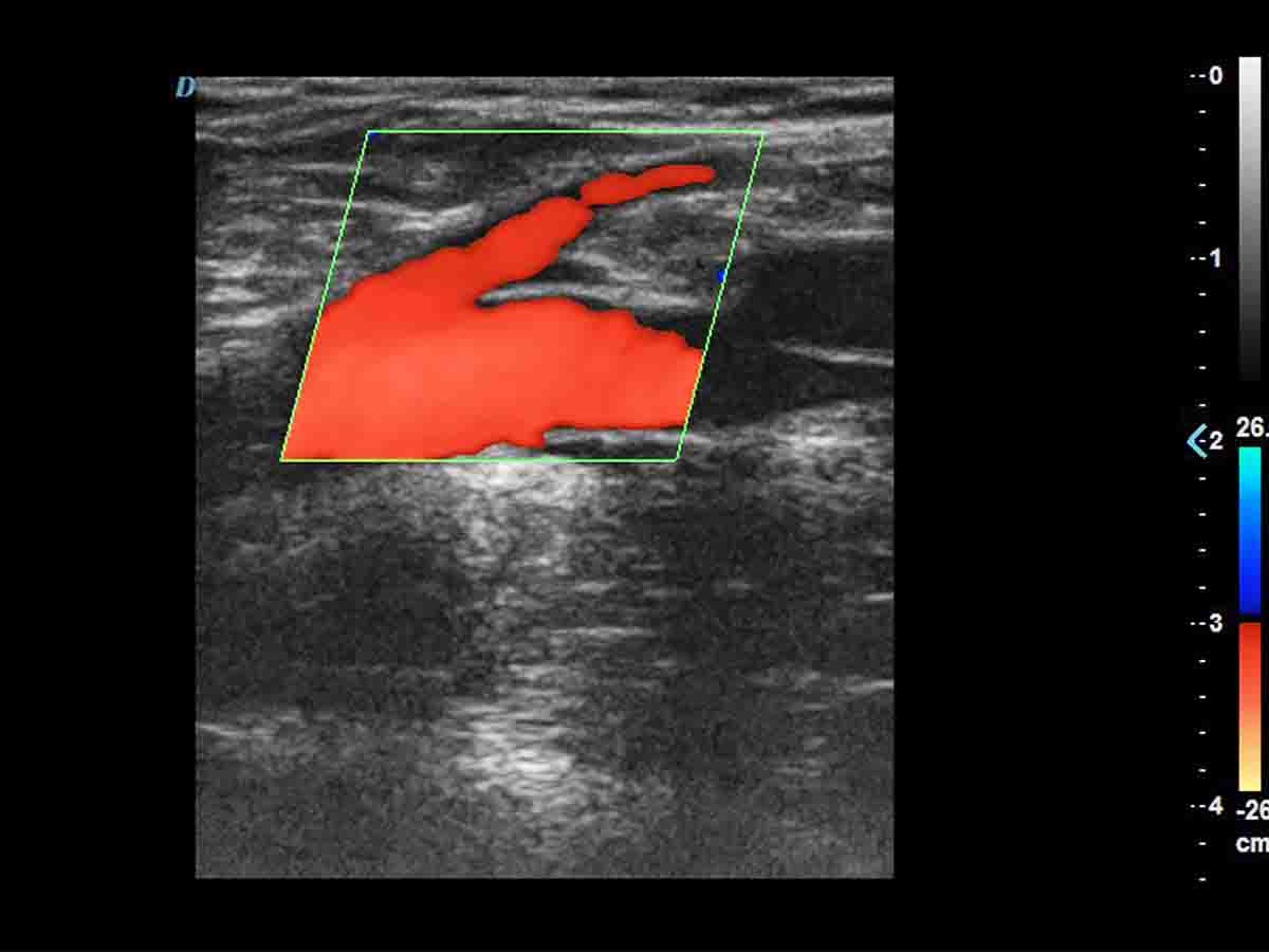 https://www.ultrasounddawei.com/news/advancing-iagnoses-with-msk-Ultrasound-machines