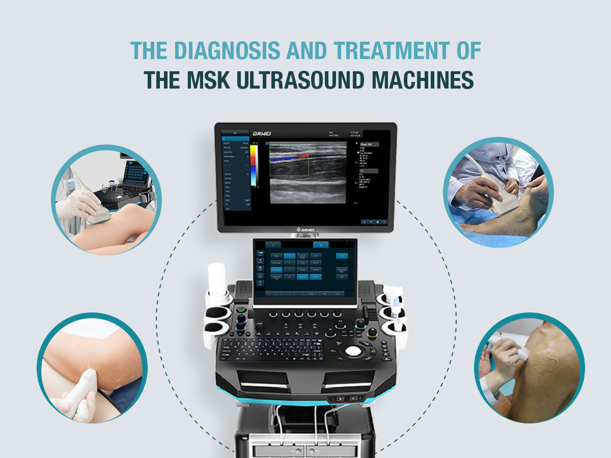 https://www.ultrasoundai.com/news/Advancing- עדזשאַנאָסעס-וויטה-מסק-ולטראַסאָונד-מאַטשינעס