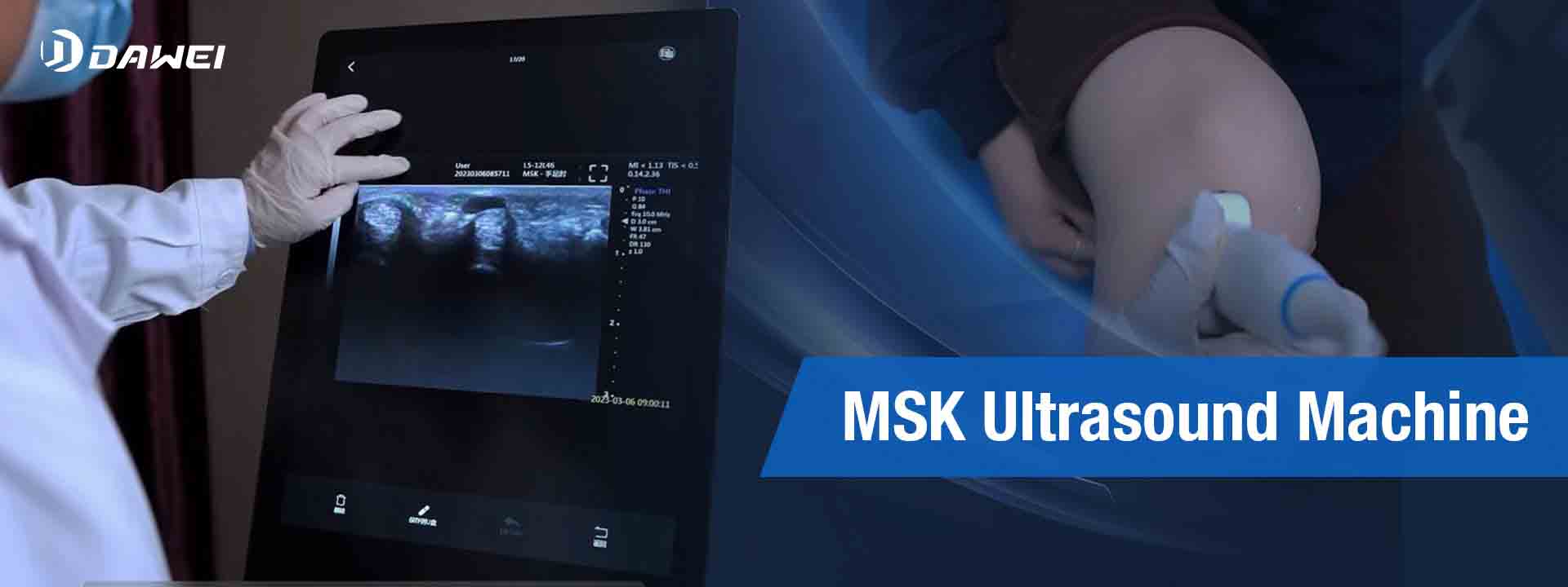 https://www.ultrasounddawei.com/news/msk-ultrasound-machine-for-sale