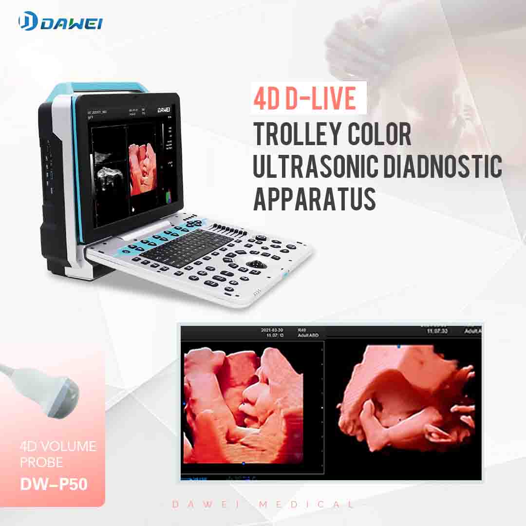 https://www.ultrasounddawei.com/4d5d-medical-echo-portable-ultrasound-scan-machine-product/