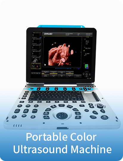 https://www.ultrasounddawei.com/best-4d5d-color-doppler-portable-ultrasound-diagnosis-system-product/