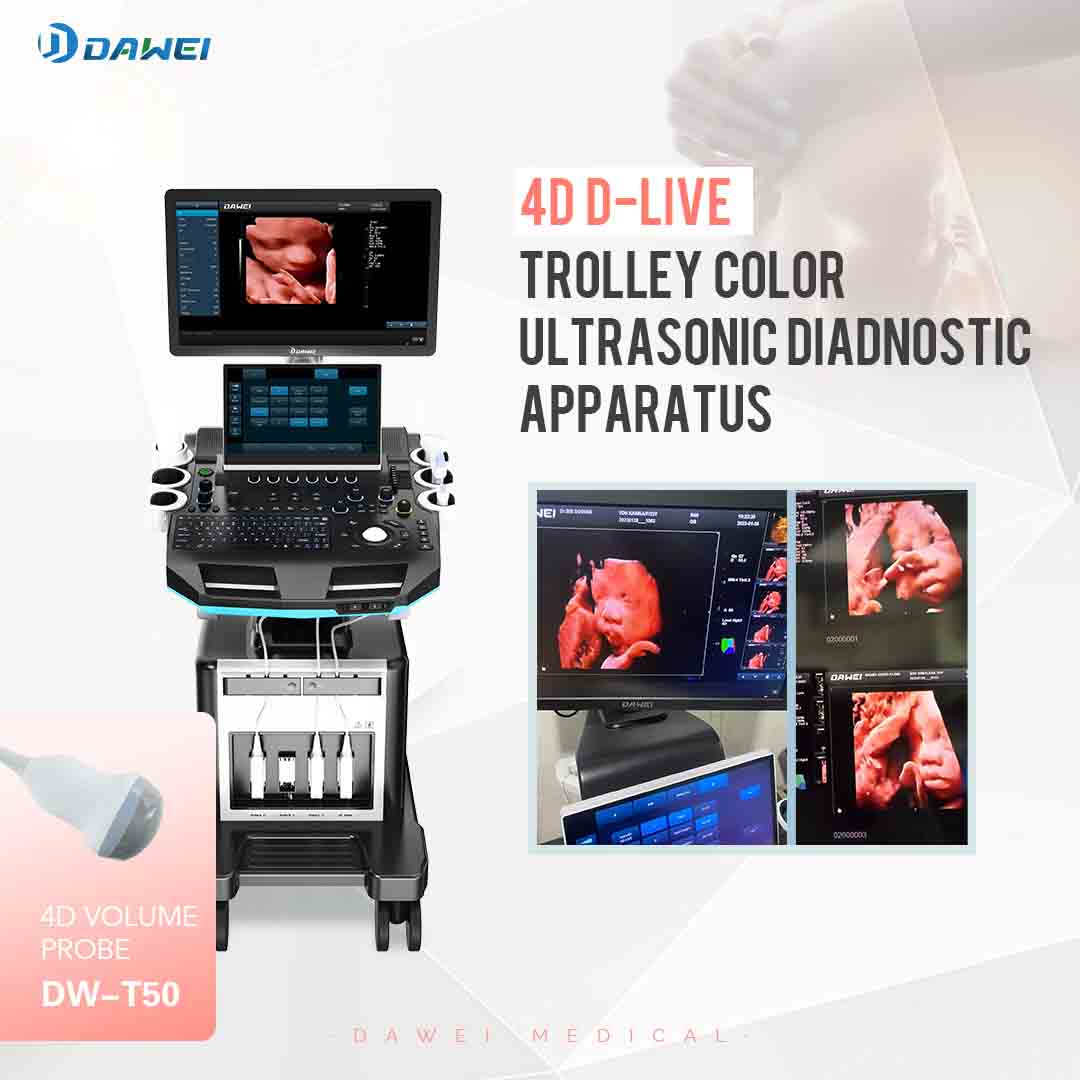 https://www.ultrasounddawei.com/dw-t50-perfect-obstetric-assistant-product/