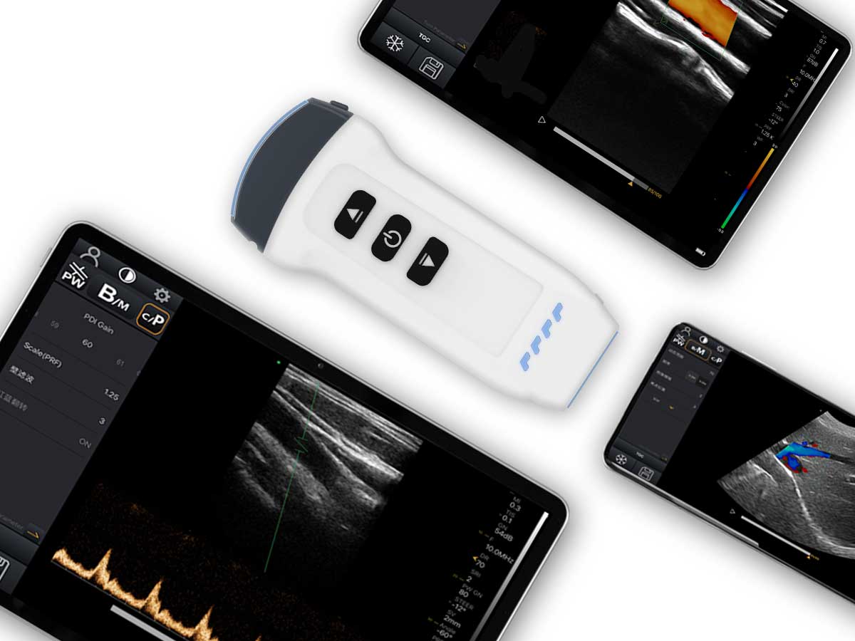 https://www.ultrasounddawei.com/amakuru/wireless-ultrasound-machine