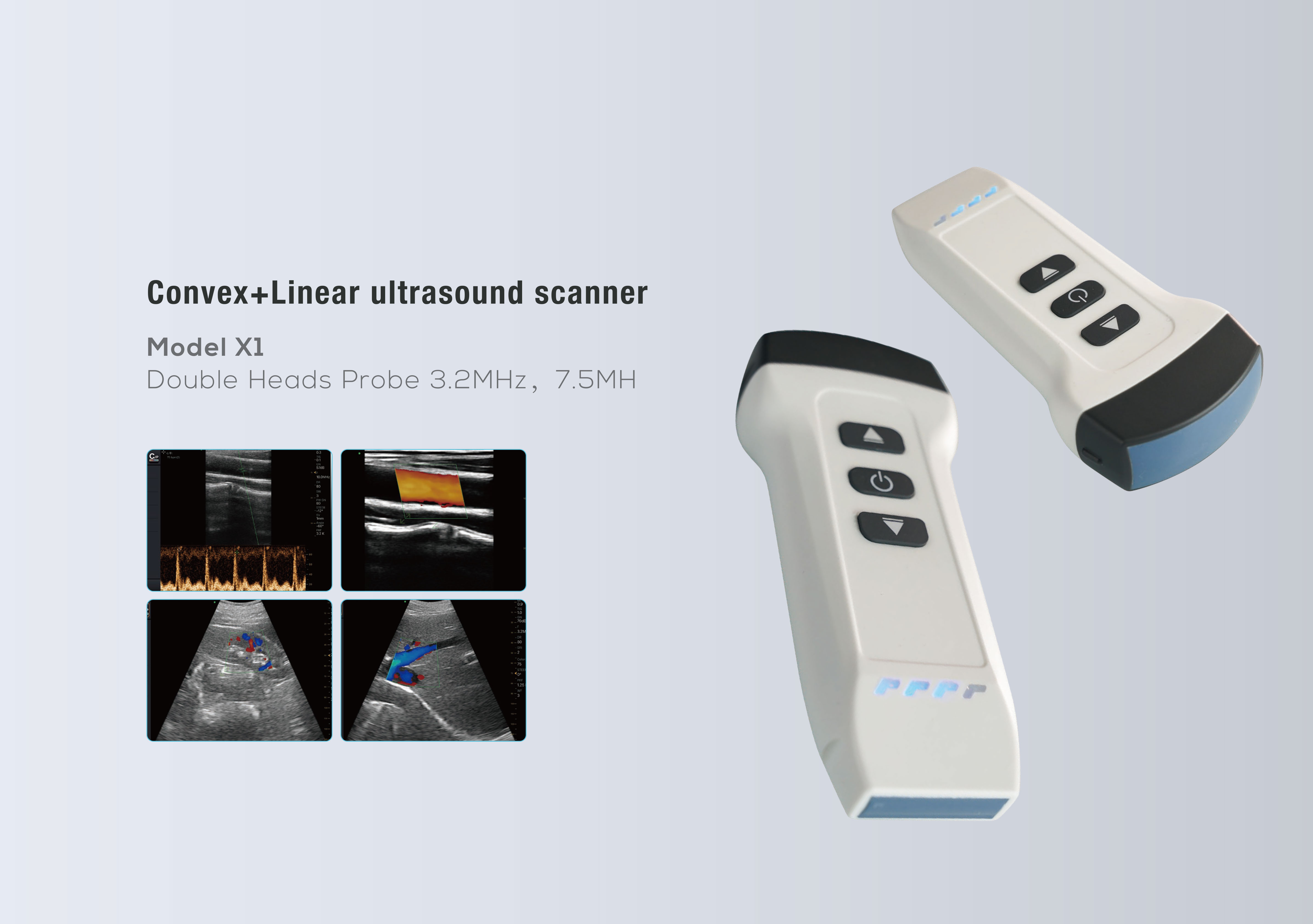 Ultrasound li jinżamm fl-idejn mingħajr fili-5