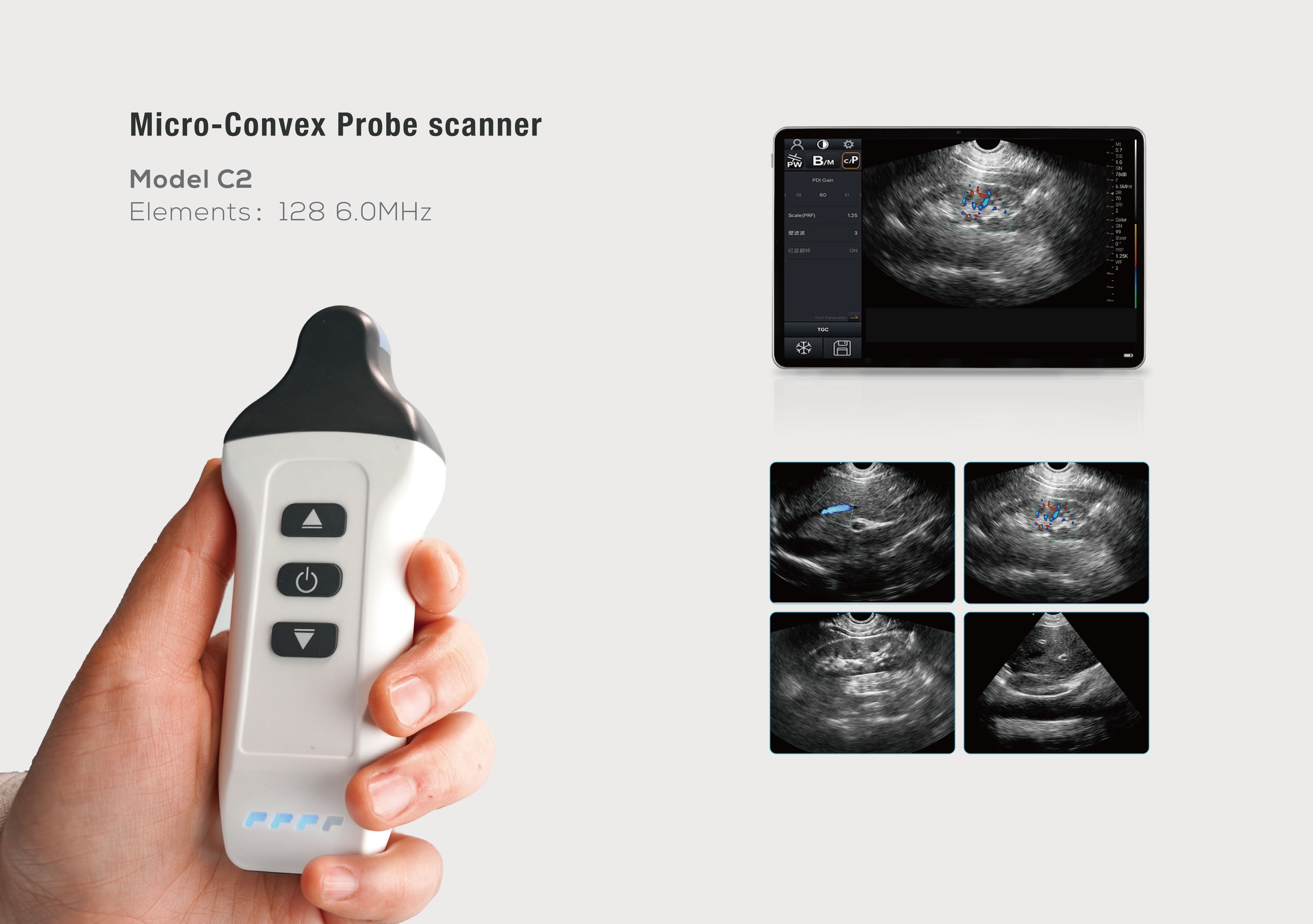 wireless-handheld-ultrasound-9